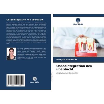 Osseointegration neu überdacht, Taschenbuch von Pranjali Bawankar, Verlag Unser Wissen, 978-620-4-15909-6