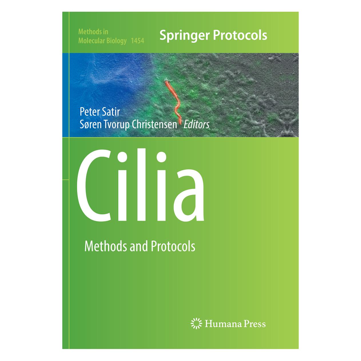 Springer Cilia (Englisch, Softcover, Peter Satir, Søren Tvorup Christensen) (56008903)