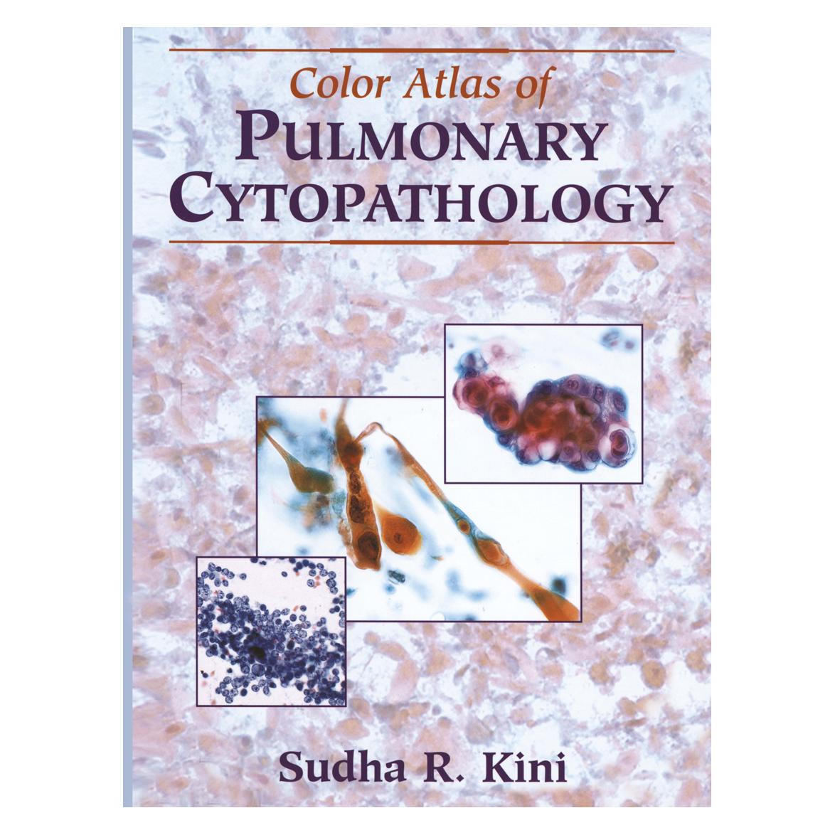 Springer Color Atlas of Pulmonary Cytopathology (Englisch, Softcover, Sudha R. Kini) (55382123)