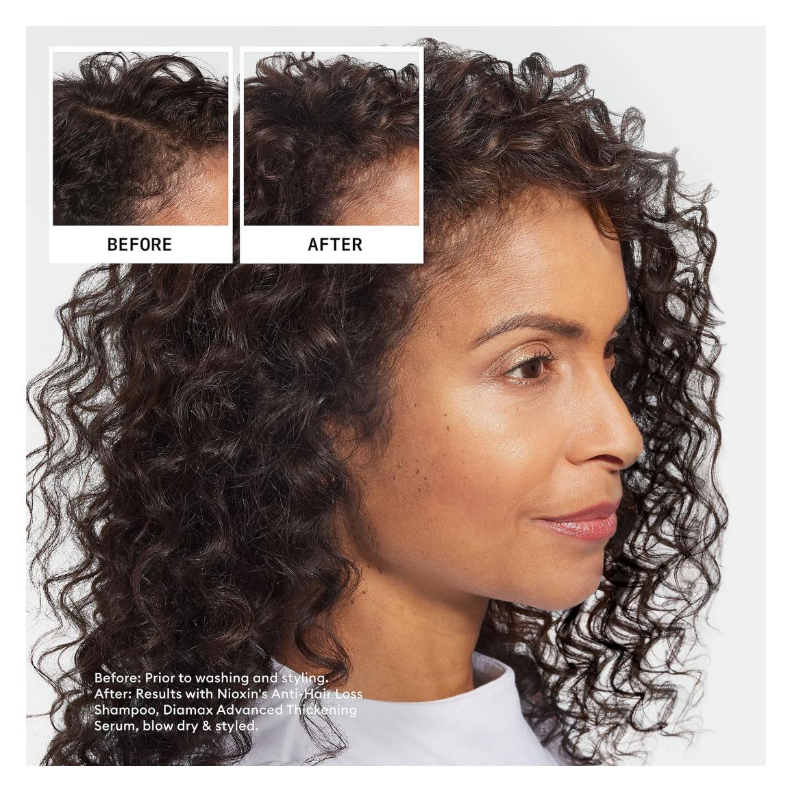 Nioxin Anti-Hairloss Ultimate Power Shampoo (74070521)