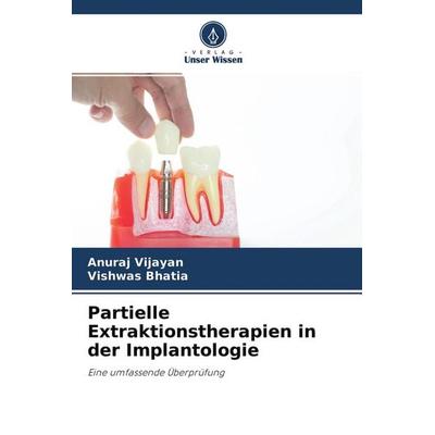 Partielle Extraktionstherapien in der Implantologie, Taschenbuch von Anuraj Vijayan,Vishwas Bhatia, Verlag Unser Wissen, 978-620-4-29324-0