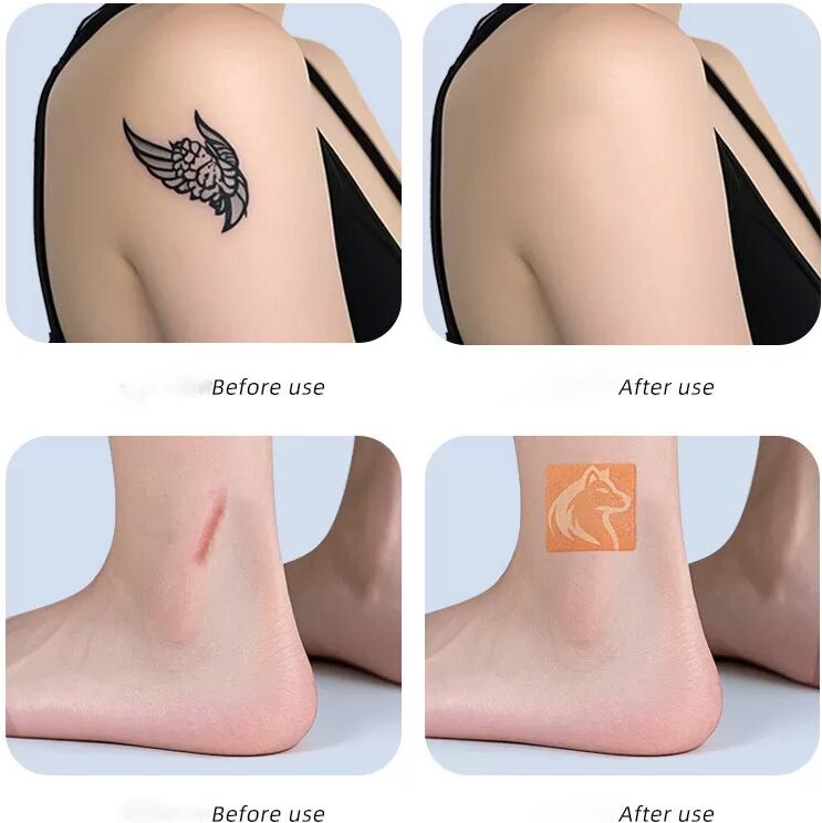 INF Lot de 10 patchs de camouflage de tatouages de formes variées - Dissimulez les imperfections et les cicatrices C
