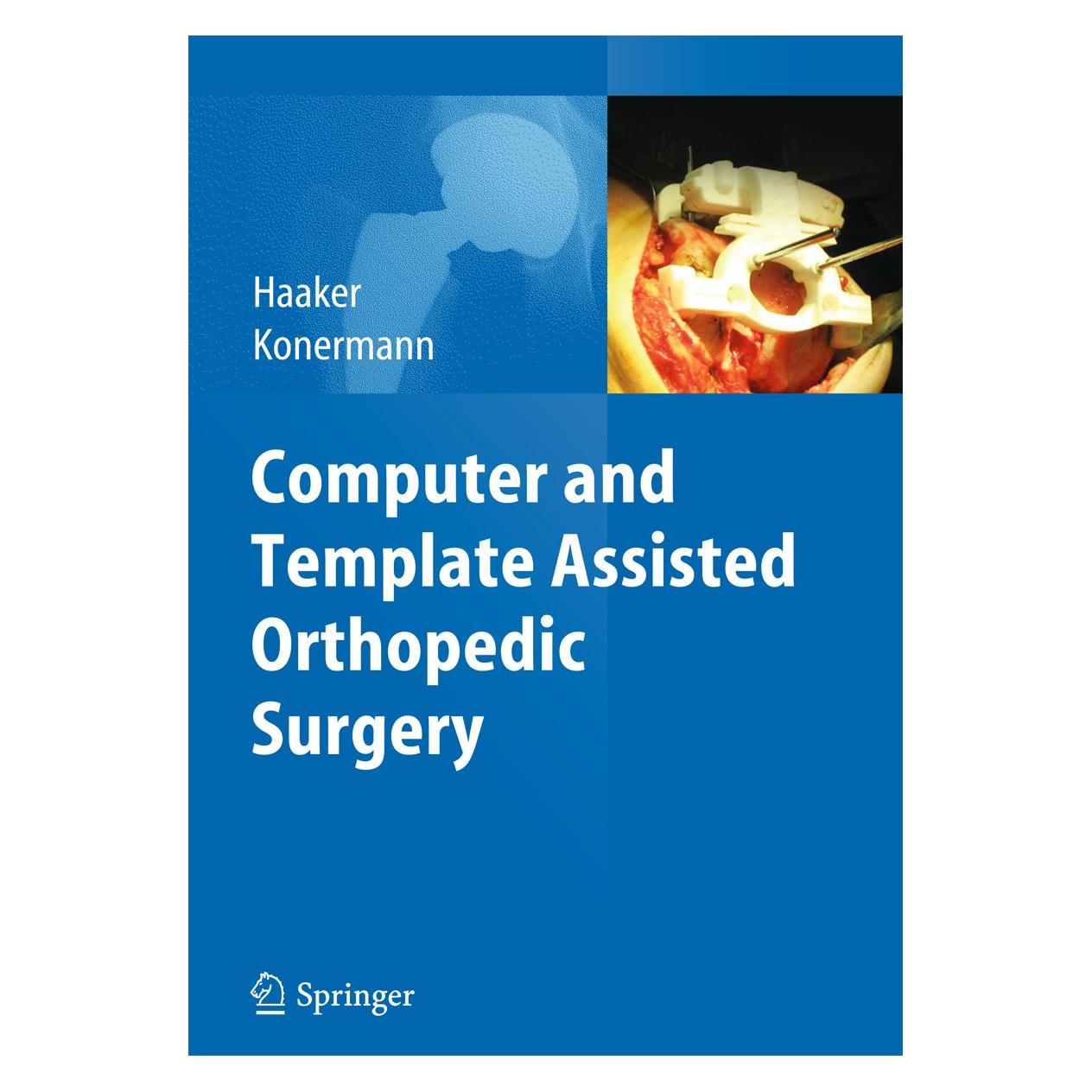 Springer Computer and Template Assisted Orthoped (Englisch, Hardcover, Rolf Haaker, Werner Konermann) (9783642297274)