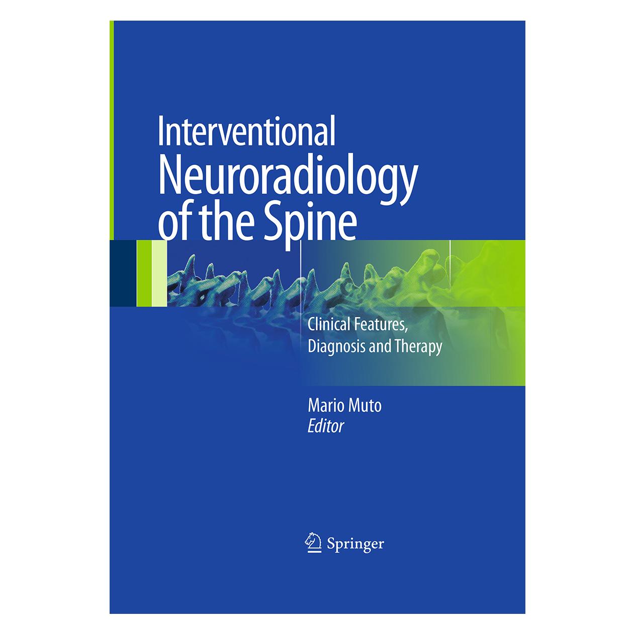 Springer Interventional Neuroradiology of the Spine (Englisch, Softcover, Mario Muto) (55948810)